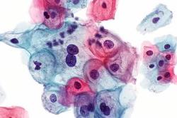 purple, blue and pink cells